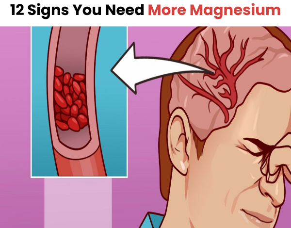 12 Signs You Need More Magnesium e1723688911473