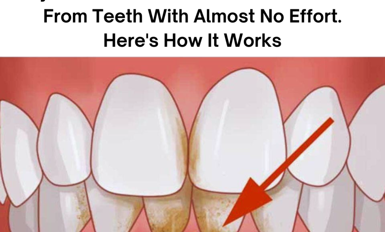 My Nanas Trick Removes Tartar Stains From Teeth With Almost No Effort Heres How It Works e1727075767180