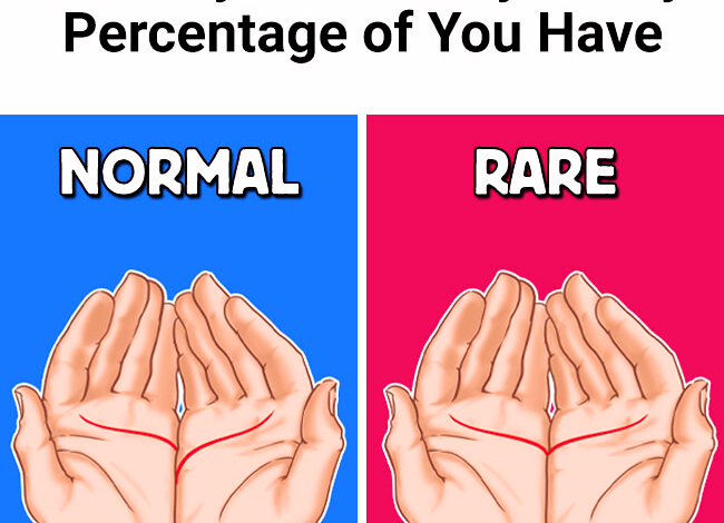 10 Body Traits Only a Tiny Percentage of You Have