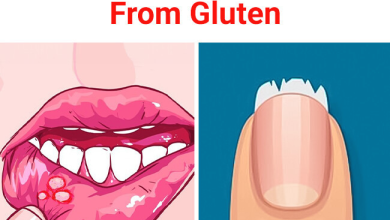 9 Clear Signs Your Body Sends When Its Suffering from Gluten